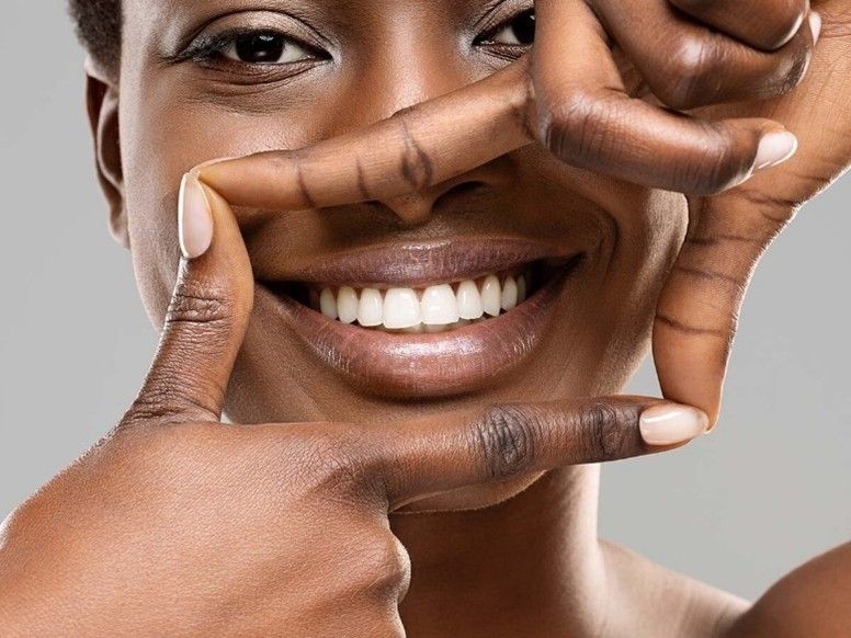 Smiling person showing healthy white teeth with hands framing face
